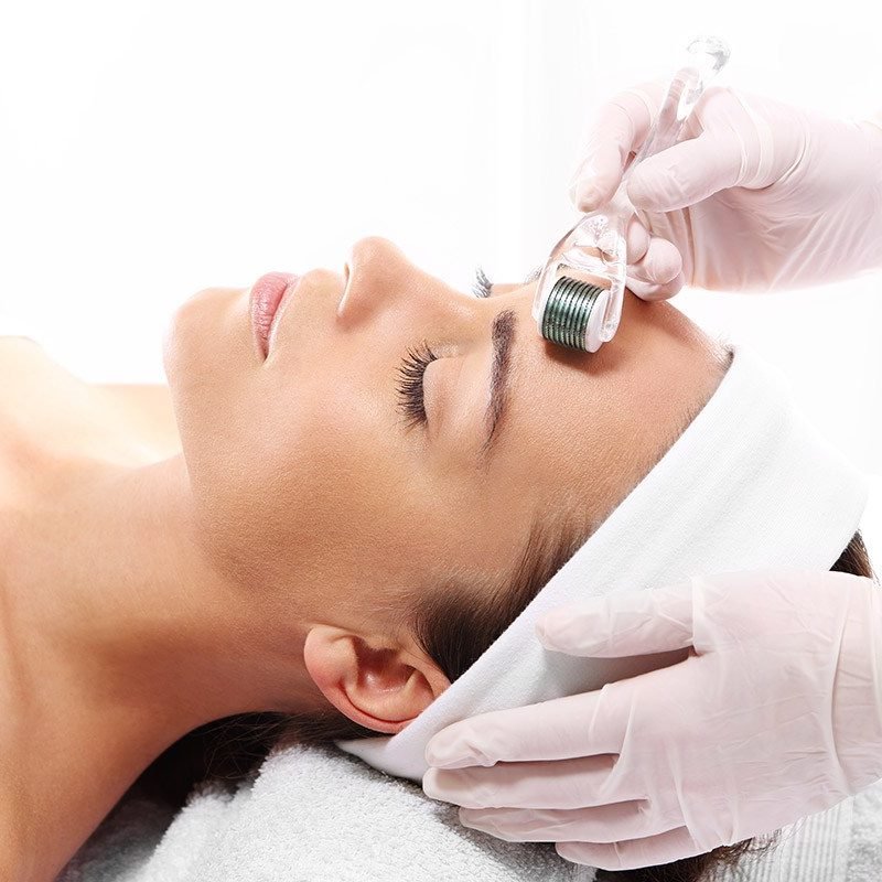 microagulhamento-facial