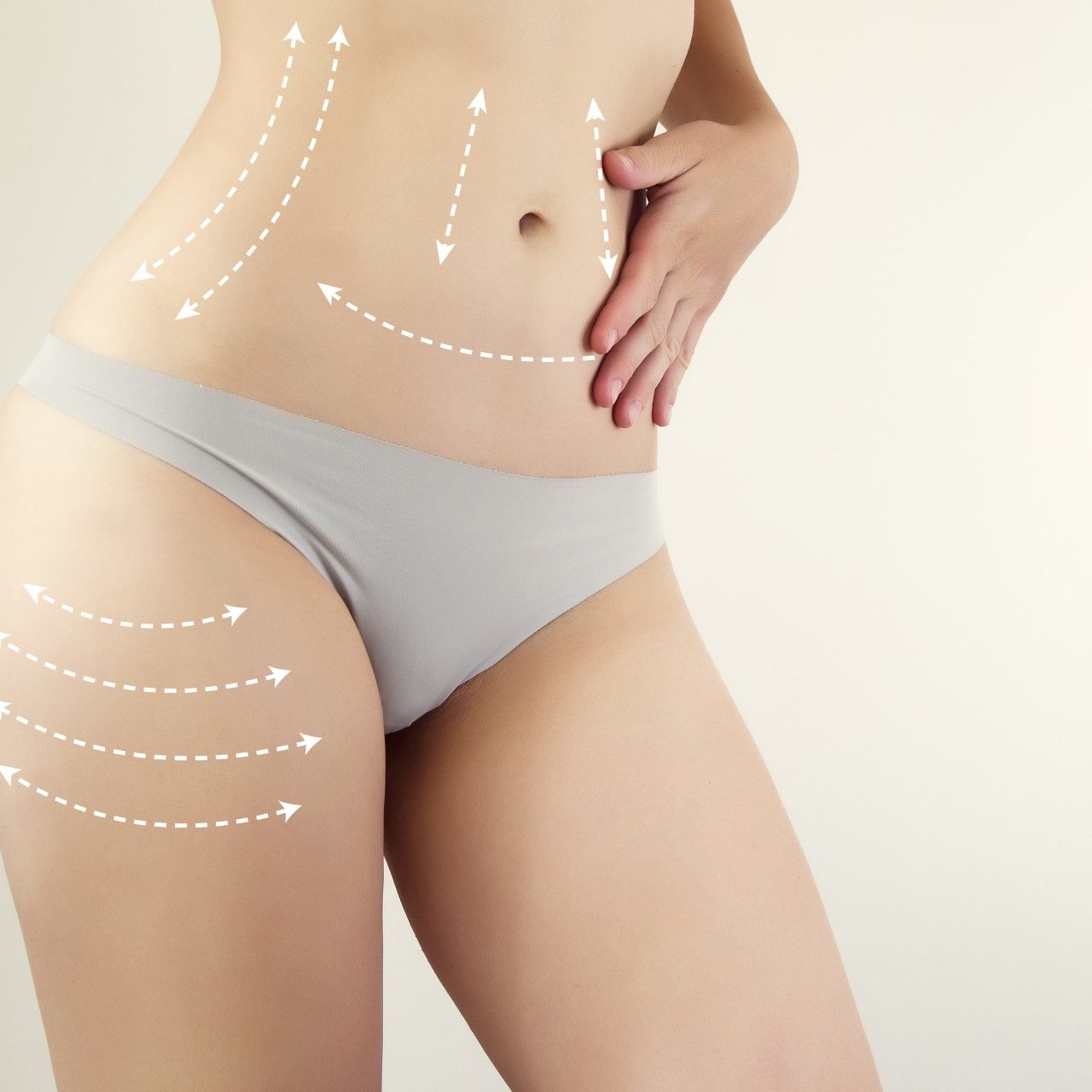 female figure highlighted with arrow symbols / liposuction marks / anti-cellulite therapy